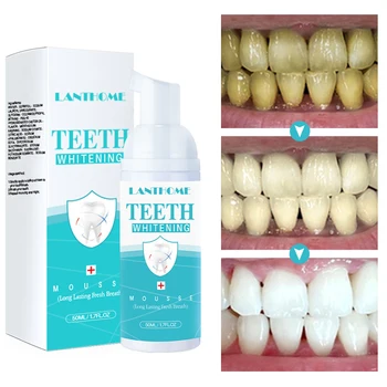 Tooth Whitening Mousse Jedlá Soda Zubní Péče Svěží Ústa Čistou Odstranění Kouře Skvrny Posílit Přírodní Složky 50ml