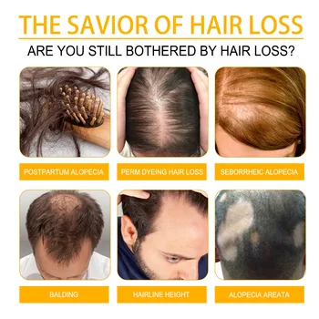 Rychlý Růst Vlasů Produkty Silný Anti-Vypadávání Vlasů Opravit Poškozené Vlasy Ztráta Léčba, Klimatizace Olej Tekuté Sérum Pro Ženy 1