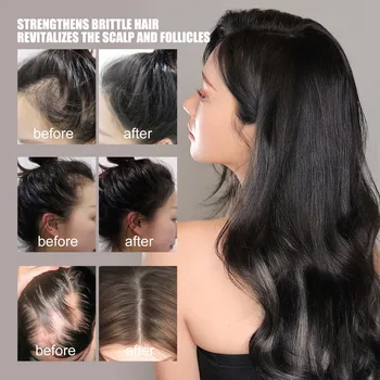 Rychlý Růst Vlasů Produkty Silný Anti-Vypadávání Vlasů Opravit Poškozené Vlasy Ztráta Léčba, Klimatizace Olej Tekuté Sérum Pro Ženy 3