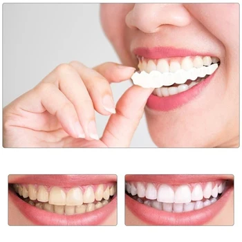 Horní a Dolní Zuby, Rovnátka, Bělení Kryt Zuby Fazety Bělení Pohodlné, ekologicky šetrné Simulovaných zubů rovnátka 1
