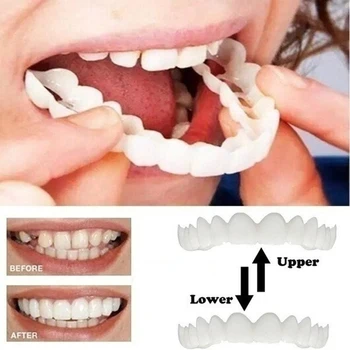 Horní a Dolní Zuby, Rovnátka, Bělení Kryt Zuby Fazety Bělení Pohodlné, ekologicky šetrné Simulovaných zubů rovnátka 2