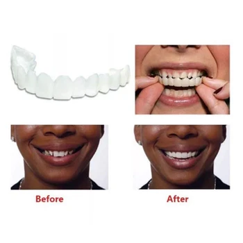 Horní a Dolní Zuby, Rovnátka, Bělení Kryt Zuby Fazety Bělení Pohodlné, ekologicky šetrné Simulovaných zubů rovnátka 3